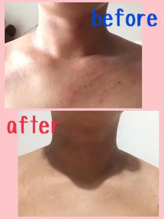 セミロング カラー パーマ ヘアアレンジ メンズ キッズ ネイル マツエク・マツパ 肌質体質を変えて すっぴん肌にのエステ・リラクイメージ
