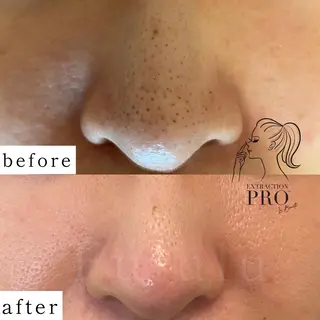 毛穴専門サロン　フルール所属・フルールFululu 自由が丘のエステ・リラクイメージ