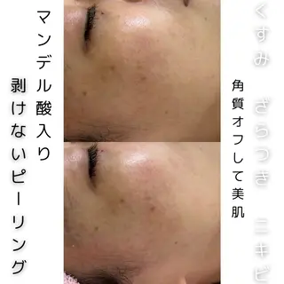 メンズ 歌舞伎町深夜サロン to mëのエステ・リラクイメージ