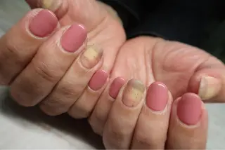 ネイル Fielia momoのネイルデザイン