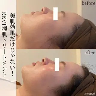 emirai 🌙AYANOのエステ・リラクイメージ