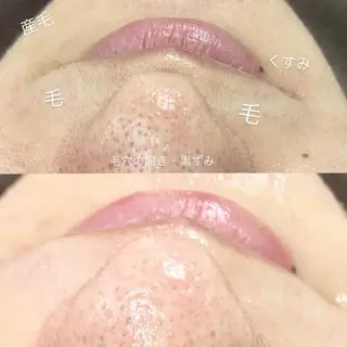 &me ayakaのエステ・リラクイメージ