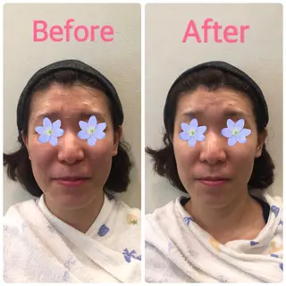 DeCoLé Beauty所属・艶肌/敏感肌/若さ/ ボディ痩身🌿のエステ・リラクイメージ