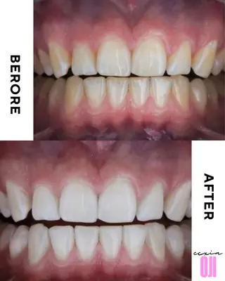 セルフホワイトニングサロン  エクシアホワイト 王寺店所属・エクシア王寺 NISHIKAWAのその他イメージ