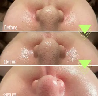 大名 Kalon（カロン）のエステ・リラクイメージ