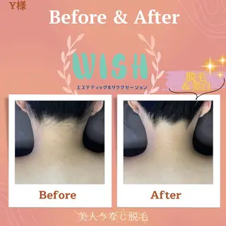 WISH 美肌脱毛のプロ！須藤のエステ・リラクイメージ