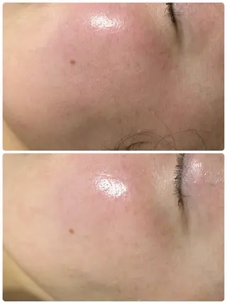 esthesalon Ran所属・小顔美肌痩身サロン Ranのその他イメージ