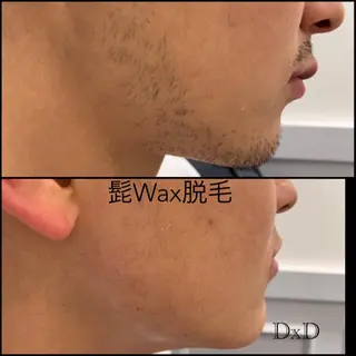 メンズ DxD ディーディのネイルデザイン