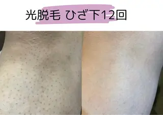 キッズ エステサロン TRINTEのエステ・リラクイメージ