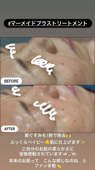 LiZA エステティックサロンのエステ・リラクイメージ