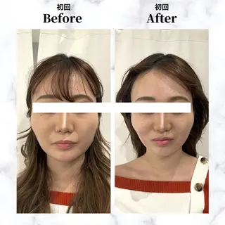 12Dハイフ💗 最強小顔のエステ・リラクイメージ