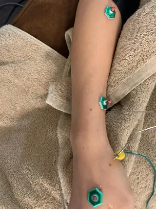 表参道鍼灸院K 美容鍼🔮ララピールのエステ・リラクイメージ