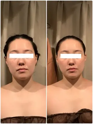 小顔整体美容を科学する【小顔FaceLabo.】横浜店所属・小顔FaceLabo 横浜店  篠原のエステ・リラクイメージ