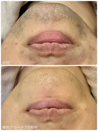 Hisui 小出のエステ・リラクイメージ