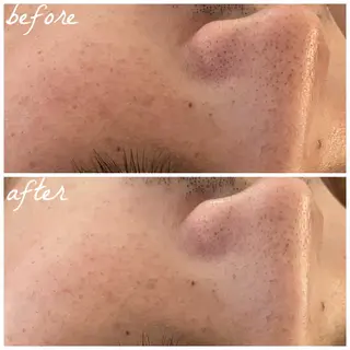 メンズ メナード岐阜市茜部 杉浦のエステ・リラクイメージ