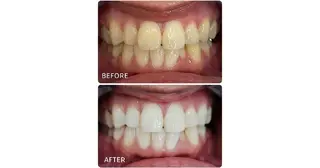 ホワイトニングサロン ラウレアのその他イメージ