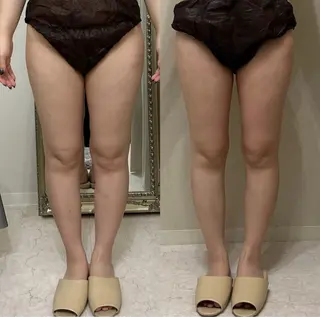 aimer 島田のエステ・リラクイメージ