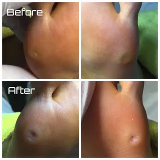 メンズ ネイル ドクターネイル爪革命 takahashiのその他イメージ