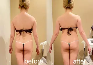 小顔＆まつ毛サロン AKANE❤️のエステ・リラクイメージ