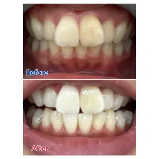 M渋谷店所属・Ｍ渋谷 ホワイトニングのその他イメージ