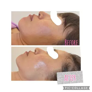 🅖🅤🅩🅔🅛 salonのエステ・リラクイメージ