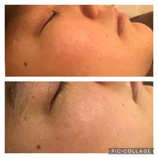 ミディアム カラー パーマ ヘアアレンジ メンズ キッズ ネイル マツエク・マツパ アニメ,Vオタク× 即効痩せエステサロンのエステ・リラクイメージ