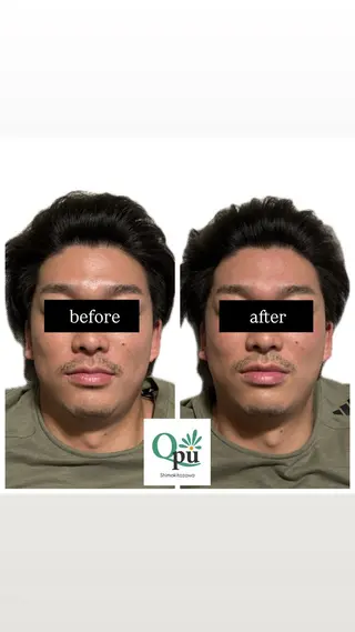 メンズ Qpu(キュープ)下北沢店所属・鮎川 さゆりのエステ・リラクイメージ