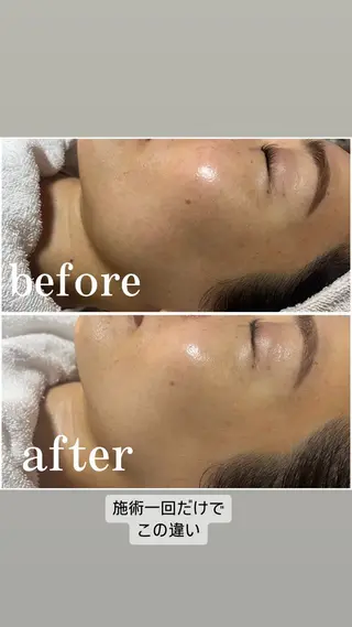 private salonR uri所属・山本 千加のエステ・リラクイメージ