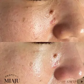 美肌専門サロン MIAJUのエステ・リラクイメージ