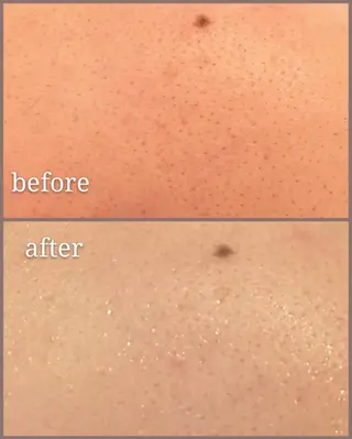 🅖🅤🅩🅔🅛 salonのエステ・リラクイメージ