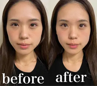 美容鍼灸サロン mahoroba院長のエステ・リラクイメージ