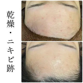 ハーブピーリング専門 BIOEL横浜のエステ・リラクイメージ