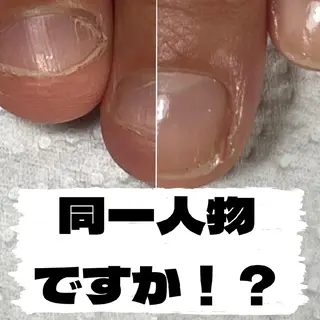ネイル nail 1623のネイルデザイン