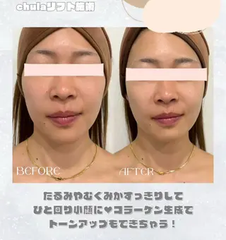 chulanail所属・arisa .のエステ・リラクイメージ