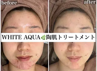 ハーブピーリング/ ララピール専門店のエステ・リラクイメージ