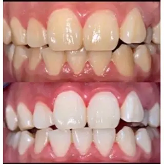 プラチナムビューティー柏所属・【歯科提携】柏ホワイ トニングスタイルのその他イメージ