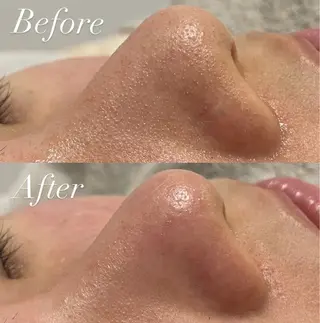 プライベートサロン Belle（ベル）のエステ・リラクイメージ