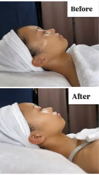 ROR Akariのエステ・リラクイメージ