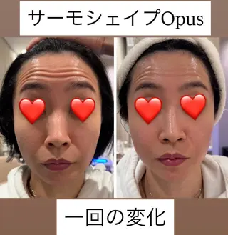 M.plus  エムプリュ所属・よもぎ蒸し、セル撃退 専門店M.plusのエステ・リラクイメージ