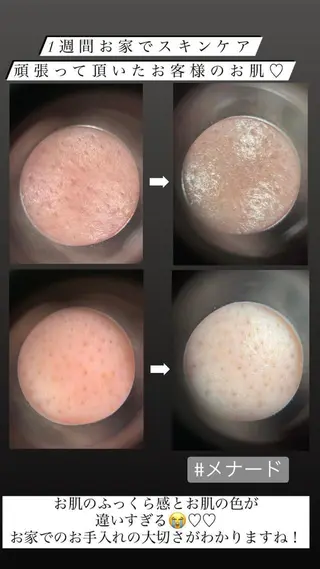 メナードフェイシャルサロン岸和田下池田西店所属・メナード 岸和田のエステ・リラクイメージ