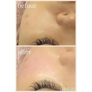 ニキビ跡専門サロン Ａｉｎａのエステ・リラクイメージ