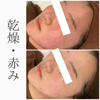 ハーブピーリング専門 BIOEL横浜のエステ・リラクイメージ