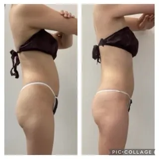 メディカルエステ 痩身·小顔専門サロンBBC 田園調布所属・KEI KOのエステ・リラクイメージ