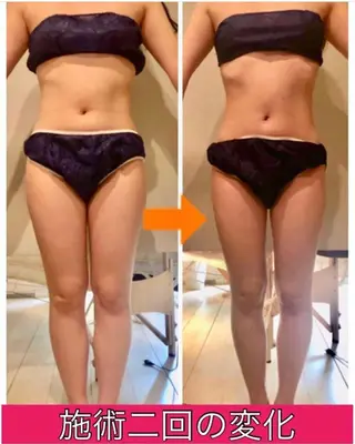 ロング カラー パーマ ヘアアレンジ メンズ キッズ ネイル マツエク・マツパ ‍痩身＆ボディ 結果出し🌟丹野のエステ・リラクイメージ