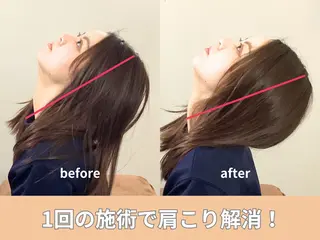 肩こり改善整体 ユアーズ【四条大宮】のエステ・リラクイメージ