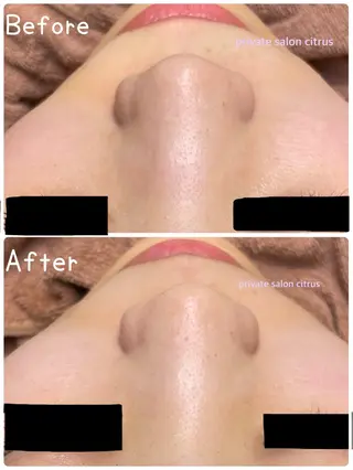 プライベートサロン Citrusのエステ・リラクイメージ