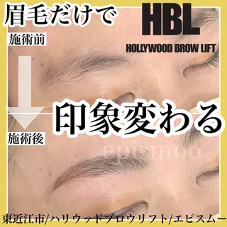 アイブロウ epismoo 脱毛/HBL/毛穴の眉毛・アイブロウイメージ