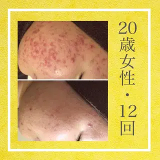 ミディアム カラー パーマ ヘアアレンジ メンズ キッズ ネイル マツエク・マツパ ニキビ・肌質改善専門 ♡人生が変わるサロンのエステ・リラクイメージ