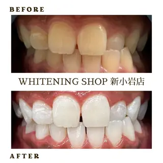 ホワイトニング ショップ新小岩店のその他イメージ