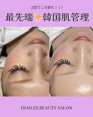 Diailes 💎ななのエステ・リラクイメージ